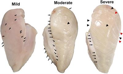 Transcriptional Profiles of Skeletal Muscle Associated With Increasing Severity of White Striping in Commercial Broilers